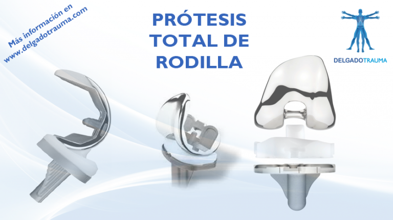 Prótesis Total De Rodilla (PTR) Dr. Delgado | DELGADOTRAUMA